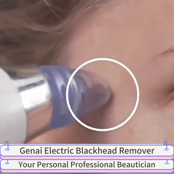 Derma suction Blackhead remover